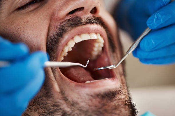 Best Chipped Tooth Repair Near Me  in County Center, VA